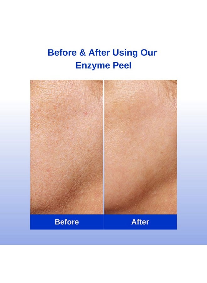 Michael Marcus - Exfoliating Enzyme Peel Papaya Pineapple & Pumpkin Enzymes Hydrating Sodium Hyaluronate & Soothing Aloe Targets Fine Lines & Wrinkles Plant Based For Smoother Skin (1.7Oz Jar) - Image 1