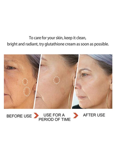 Lanthome Glutathione White Cream, Kojic Acid Brighting Dark Spots Acne Scars Intensively Hydrating Soothing Cream 50g | Best Price Qatar | Doha Lanthome Glutathione White Cream, Kojic Acid Brighting Dark Spots Acne Scars Intensively Hydrating Soothing Cream 50g | Best Price Qatar | Doha