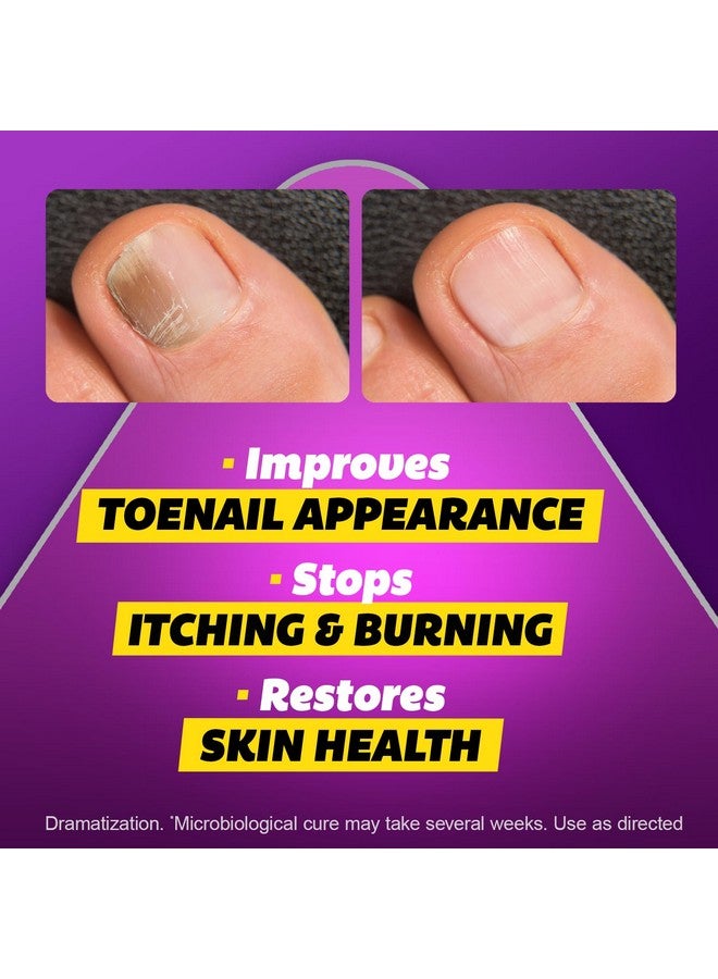 SILKA Max Strength Antifungal Liquid for Toenail Health with Brush Applicator, Results in 1 Week, Nail Fungus Treatment for Damaged Toenails, Athlete's Foot Treatment, Tolnaftate 1% 0.45 Fl Oz - Image 4