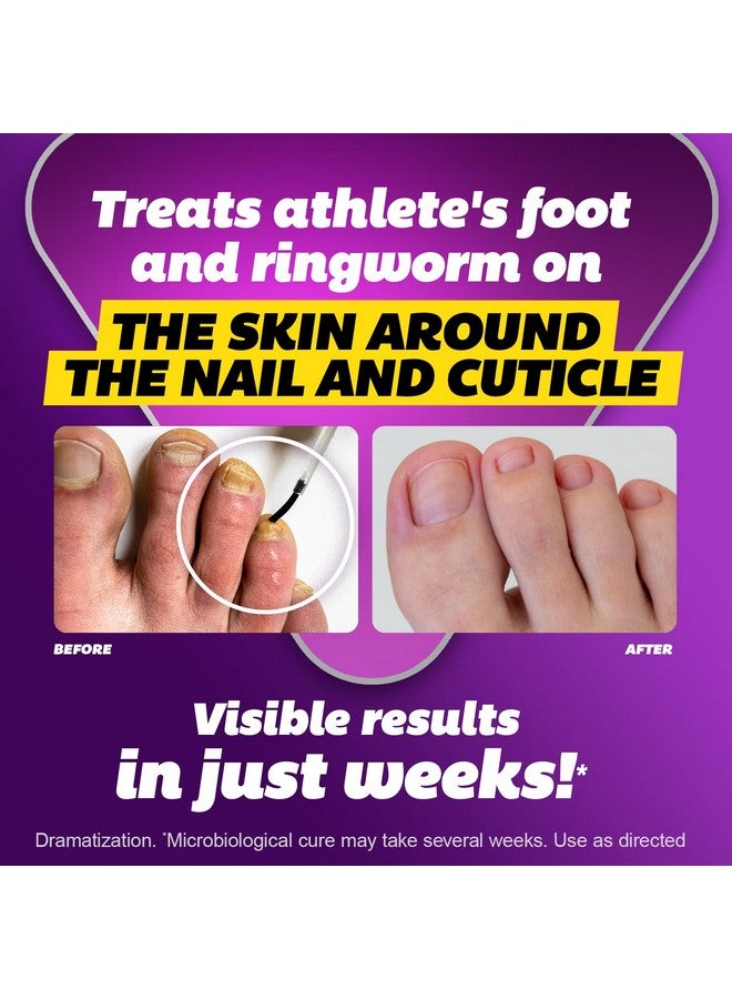 SILKA Max Strength Antifungal Liquid for Toenail Health with Brush Applicator, Results in 1 Week, Nail Fungus Treatment for Damaged Toenails, Athlete's Foot Treatment, Tolnaftate 1% 0.45 Fl Oz - Image 3