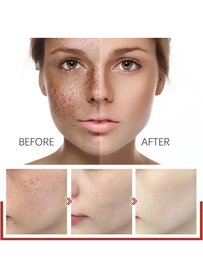 EELHOE كريم تصحيح الصبغة من EELHOE كريم إزالة النمش مصل تصحيح الصبغة إزالة الكلف بقع الشيخوخة بقع الشمس كريم تبييض إزالة النمش جوهر تفتيح فعال لإزالة صبغة الميلانين - Image 4