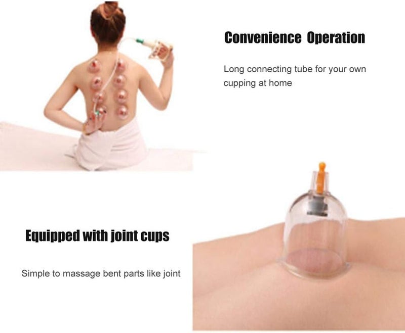 klarako Vacuum Cupping Kit, Manual Body Cupping Massage Set with Air Pump and Storage Box, Provide Good Suction and Control for Body Cupping - Image 4