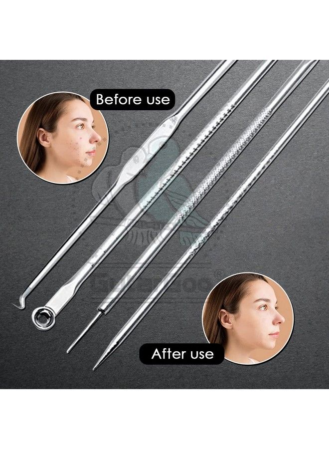 GutarGoo Blackhead Remover Pimple Comedone Extractor Tool Acne Removal Kit Treatment For Blemish Whitehead Popping Zit Removing For Nose Face Skin For Women & Men Stainless Steel (4 Pcs) - Image 5
