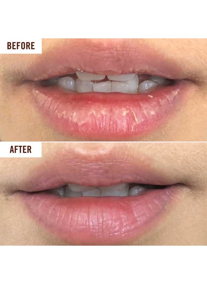 Hanalei Lip Treatment for Dry, Chapped Lips – Intensive Overnight Moisturizer with Kukui Oil, Shea Butter & Grapeseed Oil – Hydrating Balm for Healing Cracks – Clear Tint, Full-Size 15g – Cruelty-Free  - Image 5