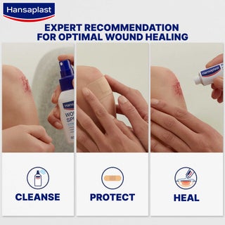 Universal Wound Plasters Water-Resistant Strong Adhesion Absorbent Non-Stick Wound Pad Breathable Plasters Multipurpose Plasters 100 Strips