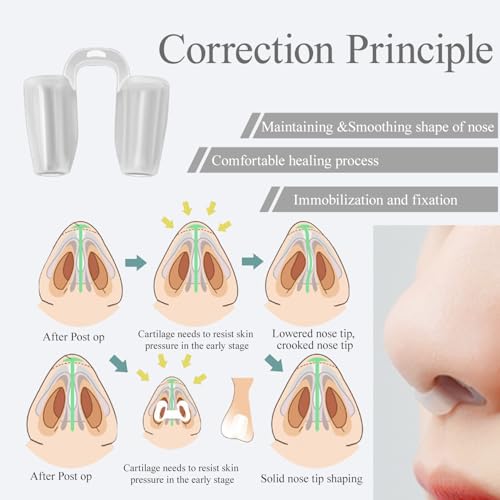 MUROCEA مثبت فتحتي الأنف - دعم داخلي للأنف لحماية كسر الدعامة، تجميل الأنف، جراحة الأنف والأذن والحنجرة، التثبيت العظمي (NO.5، OD:11mm) - Image 4