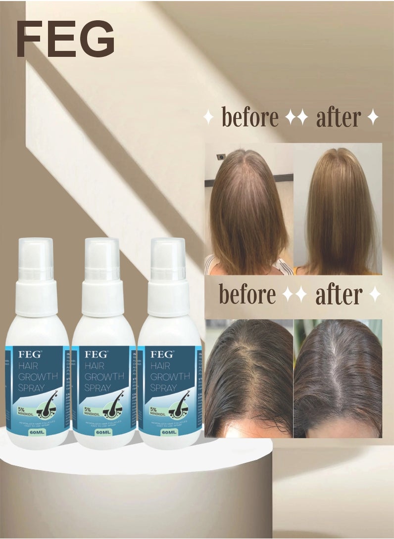 FEG 3 Pcs Hair Growth Spray 5% Minoxidil Hair Growth Oil Spray for Dry Damaged Hair and Growth Hair Scalp Oil Pure and Natural Hair Growth Serum Spray Hair Loss Treatment Oil Beard Growth Spray 60ml x 3 