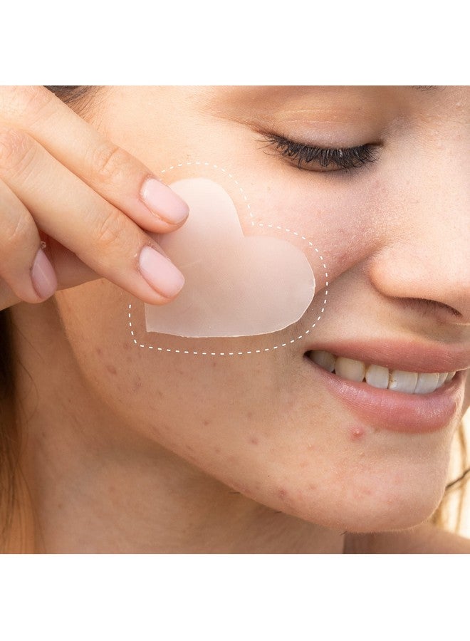Custom Blemish Patch Large Hydrocolloid Patches For Face And Body Acne And Blemish Clusters Customizable Pimple Patch Sheets Crueltyfree & Vegan 2 Patch Sheet Count