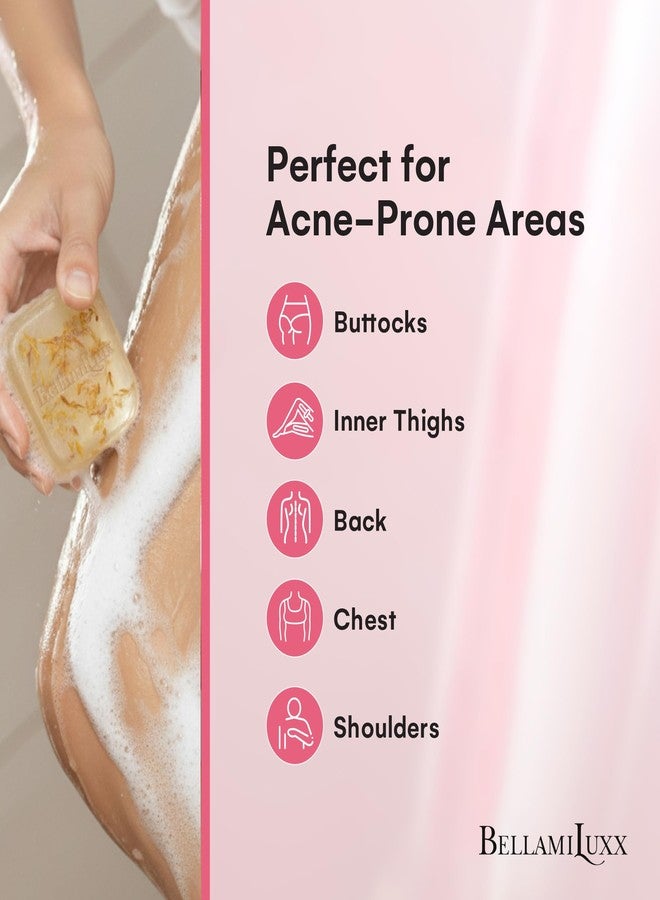 BellamiLuxx Butt Acne Treatment Set: Acne Soap Bar + Butt Treatment Lotion for Breakouts on Buttocks, Thighs, Back, Chest & Ingrown-Prone & Folliculitis-Prone Skin – Helps Reduce Body Breakouts - Image 3