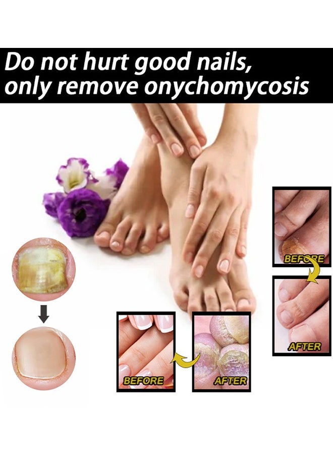 SOL LORA - Moisturizing and Repairing Nails - Grey Nail Repair Thicken & Shine Nail Moisturising Solution 30ml - Image 1