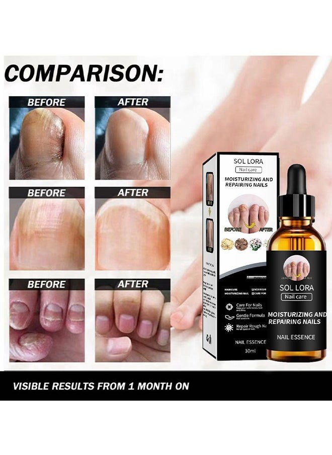SOL LORA - Moisturizing and Repairing Nails - Grey Nail Repair Thicken & Shine Nail Moisturising Solution 30ml - Image 1