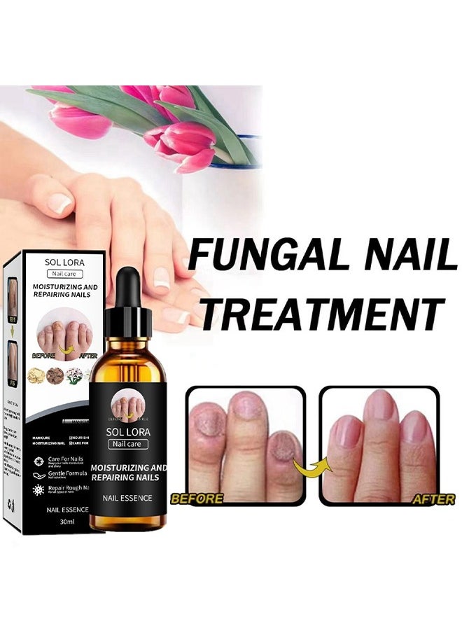 SOL LORA - Moisturizing and Repairing Nails - Grey Nail Repair Thicken & Shine Nail Moisturising Solution 30ml - Image 1