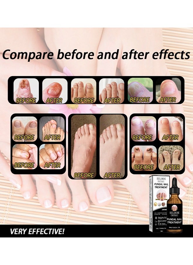 SOL LORA - Moisturizing and Repairing Nails - Grey Nail Repair Thicken & Shine Nail Moisturising Solution 30ml - Image 1