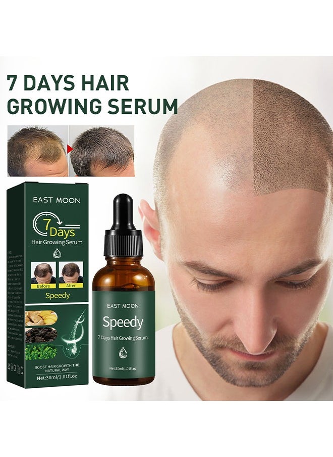 East Moon 7 Days Hair Growing Serum 30ml, Ginger Rapid Growth Hair Treatment, Anti Hair Loss Hair Regrowth Essence, Nourishing Hair Care Essential Oil  - Image 1
