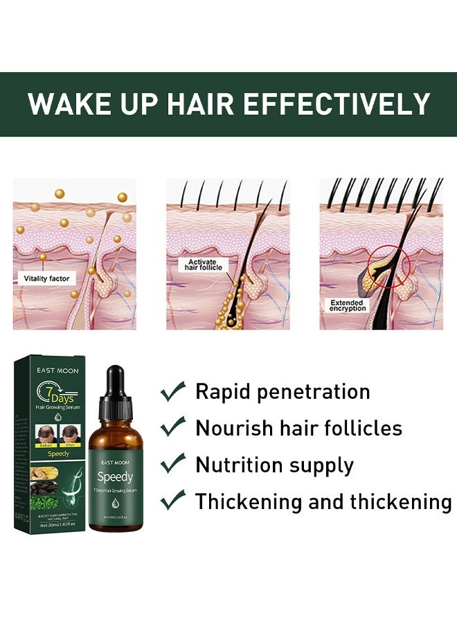 East Moon 7 Days Hair Growing Serum 30ml, Ginger Rapid Growth Hair Treatment, Anti Hair Loss Hair Regrowth Essence, Nourishing Hair Care Essential Oil  - Image 3