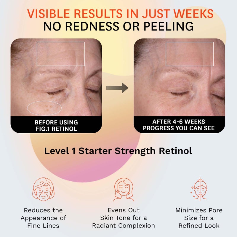 Fig.1 Retinol Night Cream | Face Hydrating Moisturizer With Retinol & Squalane | Night Cream For Women With Sensitive Skin | Dermatologist Tested Wrinkle Reduction | 50ml / 1.7 fl oz - Image 2