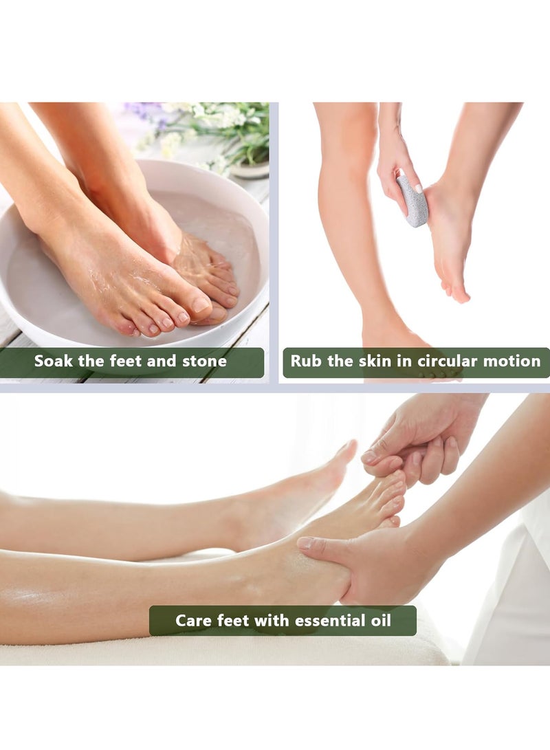 حجر خفاف طبيعي للقدم، أداة عناية من الحمم البركانية لإزالة الجلد الميت للقدمين واليدين، مجموعة من قطعتين-الوان متنوعه - Image 3