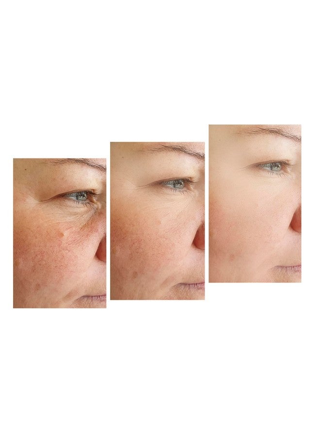 Precision Skin RX VITALITY PRECISION SKIN Clear Defense SPF 45 - Image 5