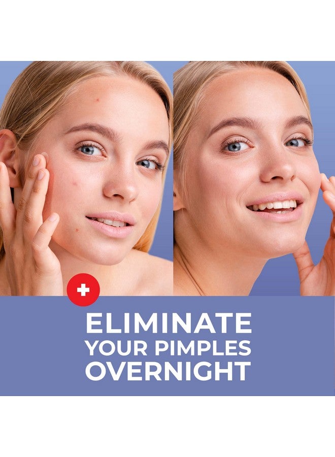 KEYCONCEPTS PatchRx Pimple Patches for Face (240 Patches), Hydrocolloid Acne Patches with Tea Tree Oil & Salicylic Acid, Pimple Patch Pimple Stickers, Hydrocolloid Patch Acne Dots Acne Pimple Patches For Face - Image 2