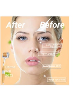 ZGTS ZGTS Micro Needle Derma Roller 1.50mm  - Image 5