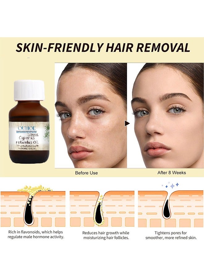أوهو زيت السايبروس المستدير ، زيت السايبر المستدير لإزالة الشعر ، زيت السايبر المستدير العطري ، زيت السرو المستدير بشكل طبيعي ، زيت السرو العضوي لإزالة الشعر 60 مل - Image 3