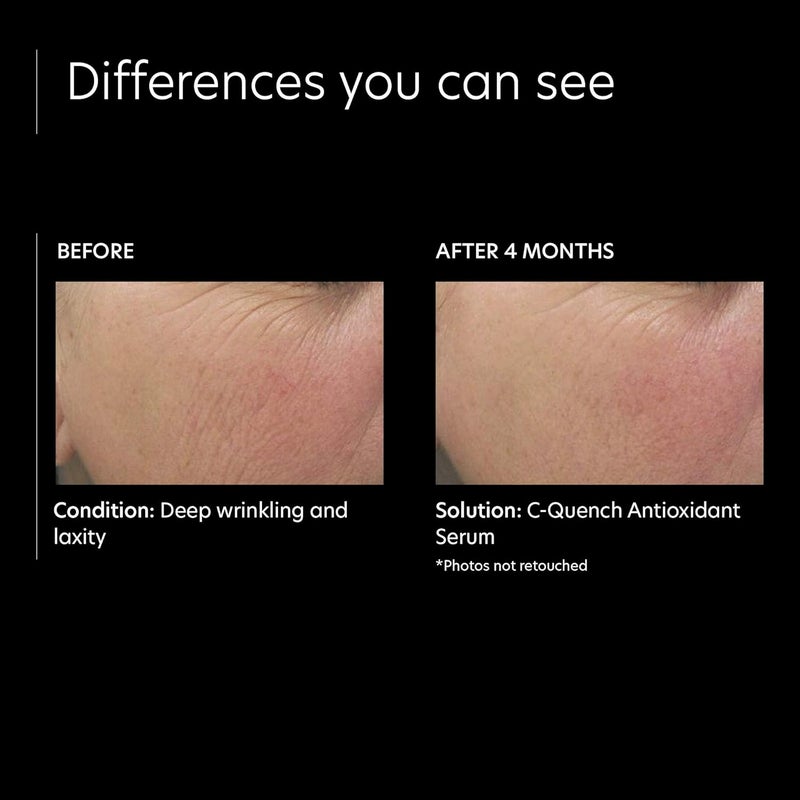 PCA SKIN C-Quench Antioxidant Serum - 1 fl. oz. (29.5 mL) for Hydration and Anti-Aging - Image 4