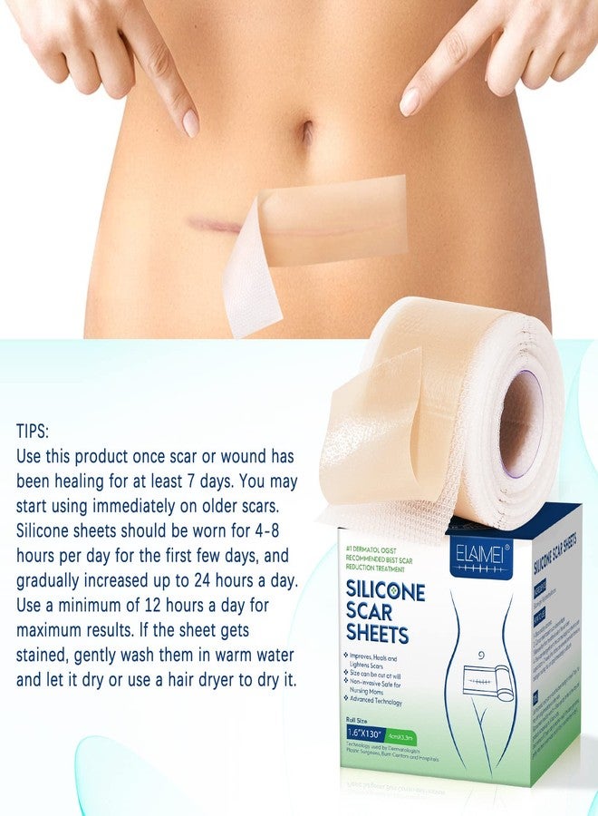 ZODENIS أوراق سيليكون لعلاج الندبات (1.6 بوصة × 130 بوصة، 3.3 متر)، شريط سيليكون احترافي لعلاج الندبات، شرائط سيليكون لعلاج الندبات، أوراق إزالة الندبات القابلة لإعادة الاستخدام للجروح الجراحية، الولادة القيصرية، الجراحة، الحروق، الكيلويد، حب الشباب - Image 4