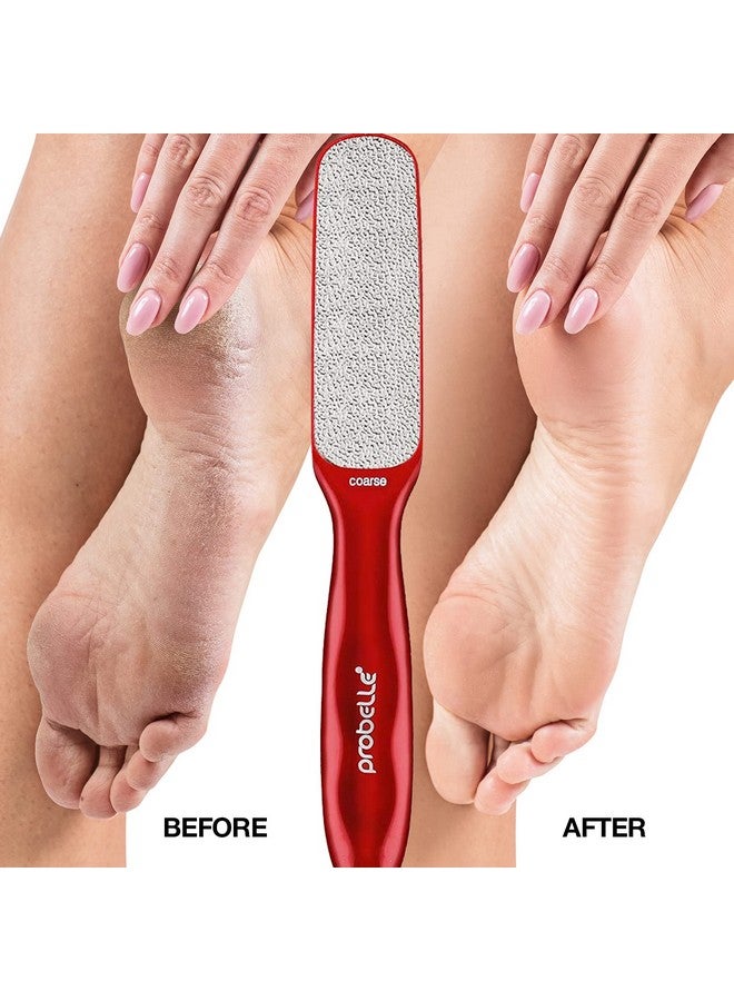 Probelle Double Sided Multidirectional Nickel Foot File Callus Remover Immediately Reduces Calluses And Corns To Powder For Instant Results Safe Tool (Red) - Image 4