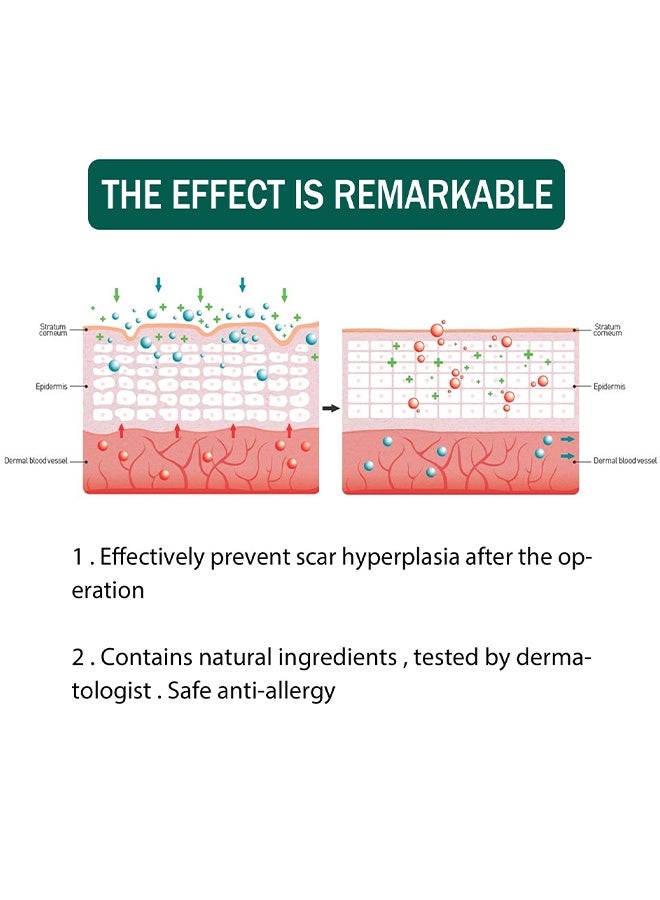 إيلهو مصل إصلاح الندبات ، زيت إزالة الندبات بمكونات طبيعية ، مناسب للندبات الجراحية ، الولادة القيصرية ، علامات التمدد ، حب الشباب ، الإصابات ، الحروق ، الجدرة ، الندبات القديمة والجديدة 30 مل - Image 3
