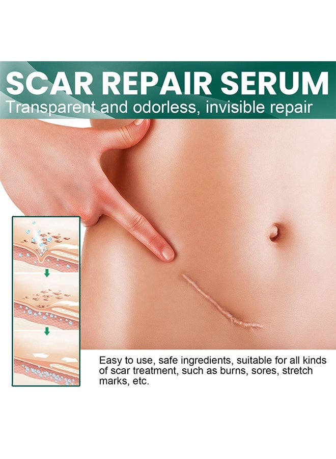 إيلهو مصل إصلاح الندبات ، زيت إزالة الندبات بمكونات طبيعية ، مناسب للندبات الجراحية ، الولادة القيصرية ، علامات التمدد ، حب الشباب ، الإصابات ، الحروق ، الجدرة ، الندبات القديمة والجديدة 30 مل - Image 2