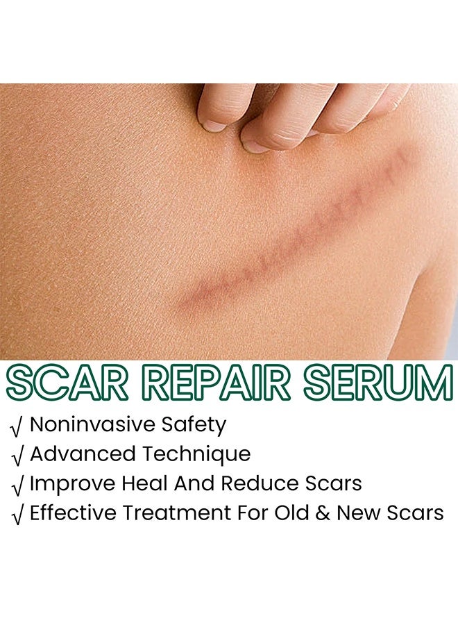 إيلهو مصل إصلاح الندبات ، زيت إزالة الندبات بمكونات طبيعية ، مناسب للندبات الجراحية ، الولادة القيصرية ، علامات التمدد ، حب الشباب ، الإصابات ، الحروق ، الجدرة ، الندبات القديمة والجديدة 30 مل - Image 4