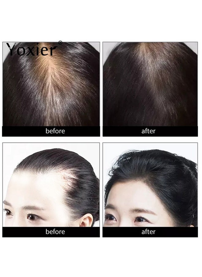Yoxier - Hair Growth Thick Essential Oil，Natural Polygonum Multiflorum Hair Essential Oil, He Shou Wu For Man and Woman Hair Loss, Make Hair Smoother & Shinier 20ml - Image 1