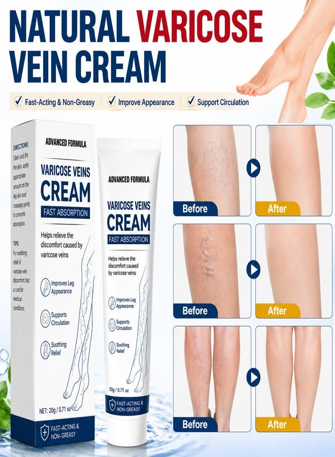 Vigorder Varicose Veins Treatment for Legs, Varicose Veins Cream for Spider Veins, Helps Improve Circulation, Relieves Tired Heavy Feeling, Moisturizing Support for Daily Leg Care - Image 4