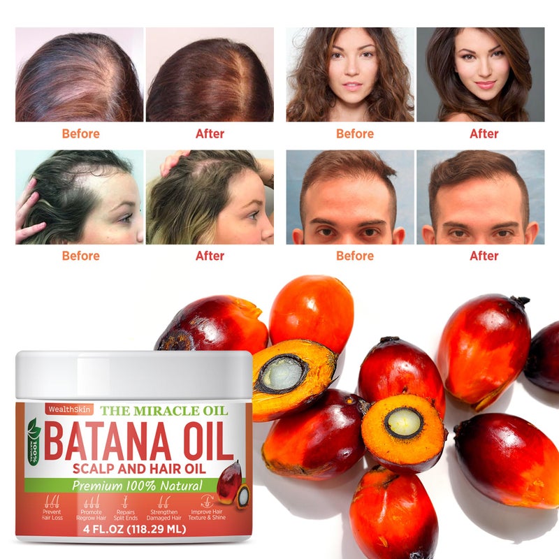Wealthskin Batana Oil from Honduras: Hair Growth Mask, Repairs Damaged Hair & Skin, Reduces Hair Loss (118ml) - Image 2