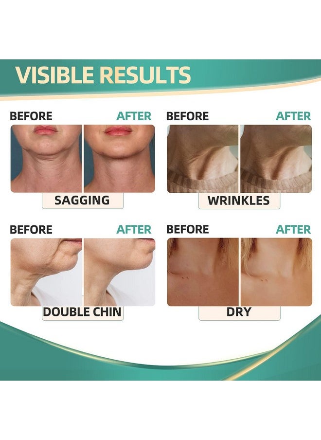 RONKIE - Neck Cream For Tightening Firming Instant Face Lift Cream Wrinkle Cream For Women Anti Wrinkle Cream With Retinol Collagen & Hyaluronic Acid Lifting Firming & Hydrating 1.7 Fl Oz - Image 1