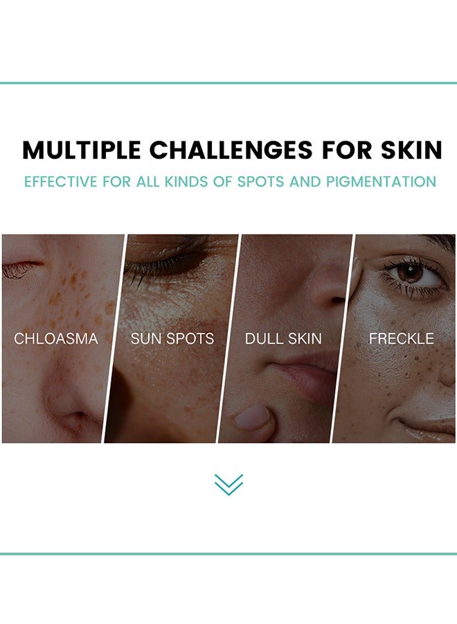 سوميفون كريم تخفيف الكلف لعلاج فرط تصبغ الوجه البقع الداكنة والكلف والنمش وإزالة البقع الشمسية كريم مصحح البقع الداكنة للنساء والرجال 20 غرام - Image 4