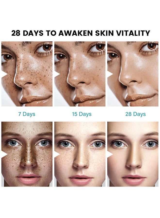 سوميفون كريم تخفيف الكلف لعلاج فرط تصبغ الوجه البقع الداكنة والكلف والنمش وإزالة البقع الشمسية كريم مصحح البقع الداكنة للنساء والرجال 20 غرام - Image 5