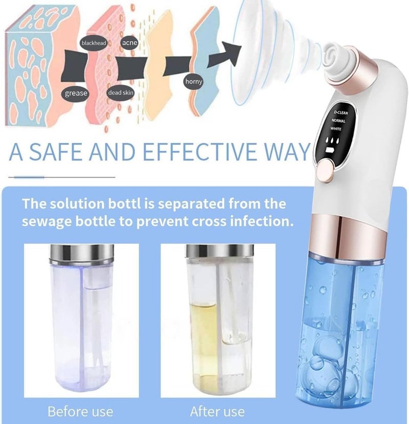 ADAK Electric Blackhead Remover Pore Vacuum Cleaner, Small Bubble Water Cycle Suction Facial Device for Acne, Pimple & Comedo Removal, Deep Pore Cleansing Beauty Tool (L) - Image 4