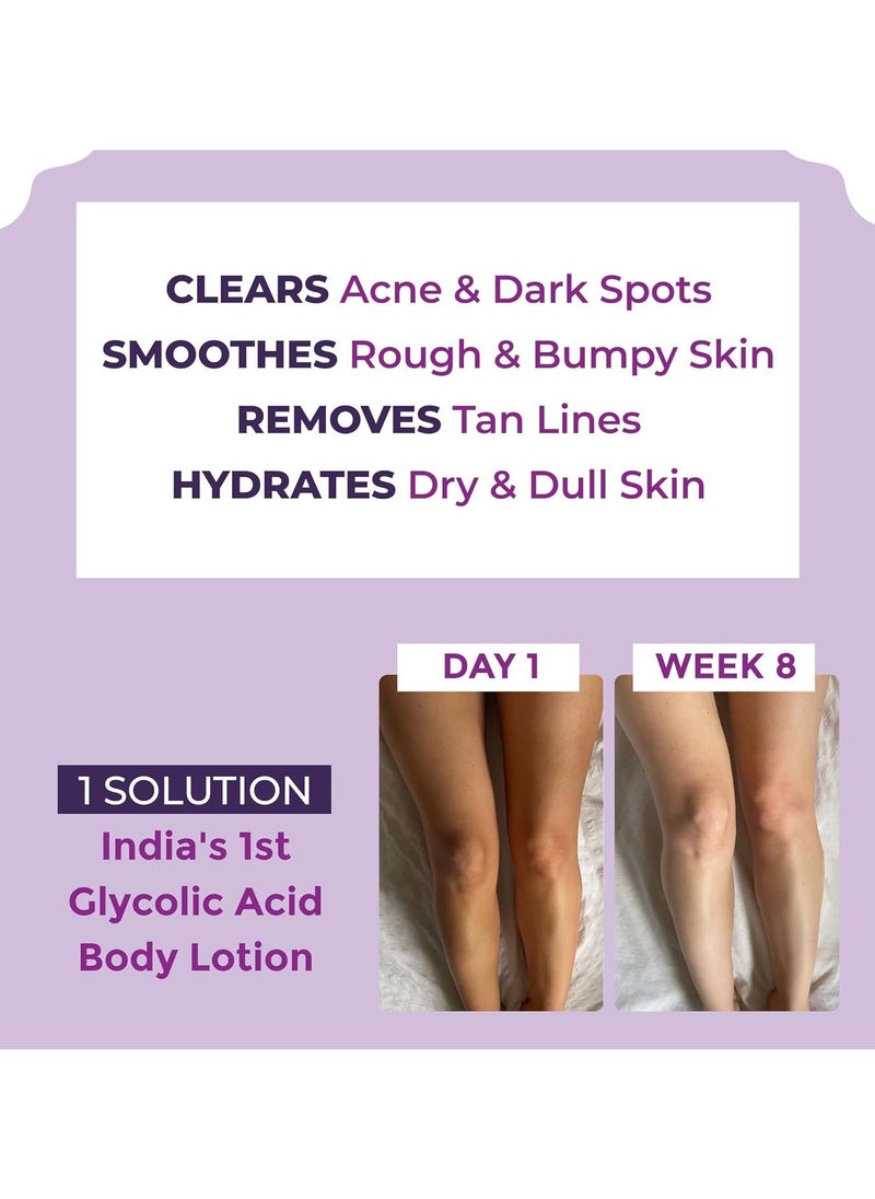 Clear Confident Glycolic Acid Body Lotion AHA Exfoliation Rough Bumpy Skin Tan Acne Strawberry Skin Niacinamide Lactic Salicylic Acid Smooth 200ml - pzsku/Z0F1D213A88CAE6DEA9C0Z/45/_/1740471287/5f085911-42f4-4a21-8b76-6467f60869e0