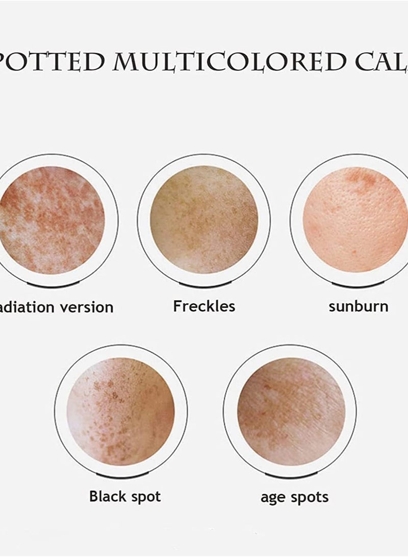 Karim Dr. Hansi White Spot Cream 20 gm - Image 4