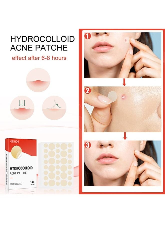 EELHOE 144 Pcs Hydrocolloid Acne Patche Set Healing Acne And Pustule Can Be Used Day And Night  - Image 3
