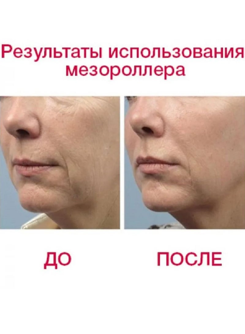 اداة تدليك البشرة والمساعدة على علاج علامات التمدد بعد الحمل - Image 5