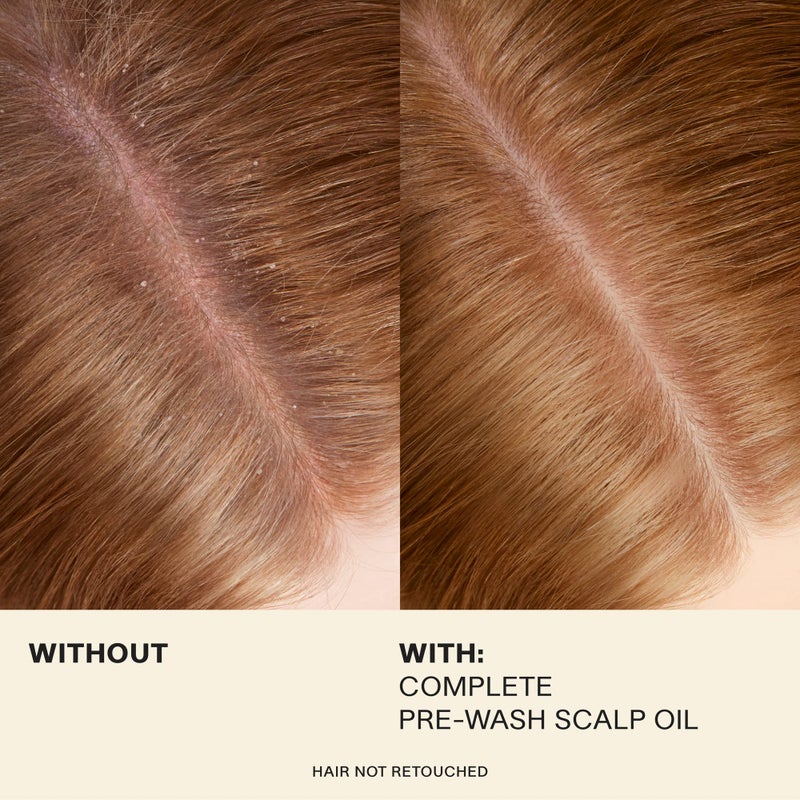 JVN Complete Pre-Wash Scalp Oil, 1.7 Fl Oz, Hair Treatment and Scalp Clarifying Oil Made with Rosemary Extract, Hair Care for Women and Men, Silicone Free - Image 3