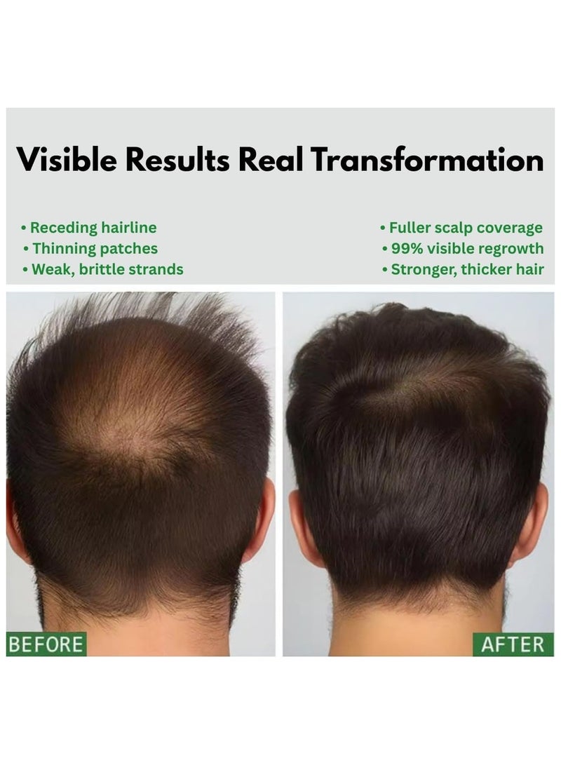 Nouelv Batana Oil for Hair Growth – 100% Pure & Natural Raw Batana Oil from Honduras, Thickens & Strengthens Hair – Deeply Moisturizing Hair Oil for All Hair Types – 4 FL OZ – Unrefined & Cold-Pressed  - Image 4