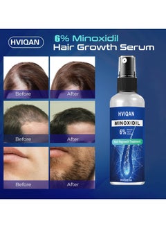 6% Minoxidil Hair Growth Spray For Men and Women，Hair Regrowth Treatment Serum For Stronger Thicker Longer Hair Help to Stop Thinning And Loss Hair 60Ml - pzsku/Z0F3D71DA47A8BD6D7D54Z/45/_/1739498229/5022d67d-ebdb-44ec-aa1c-cad554886db3