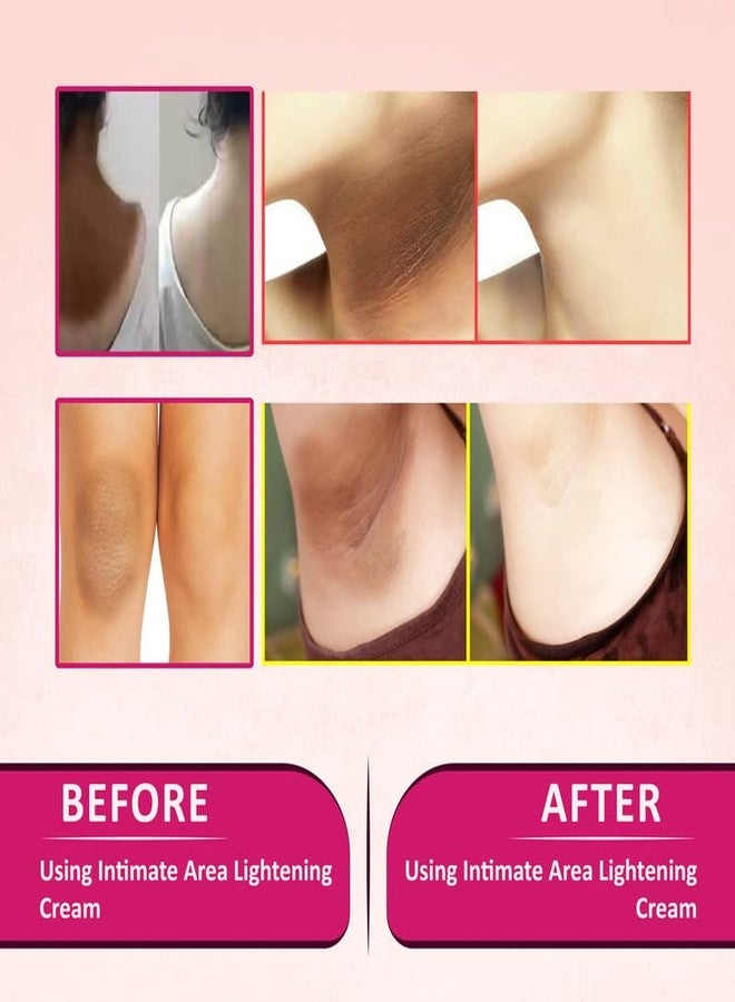 SABATES Intimate Area Lightening Cream For Dark Spots For Dark Underarms, Neck, Knees, Elbows & Inner Thigh | Intimate Area Whitening Cream - Image 4