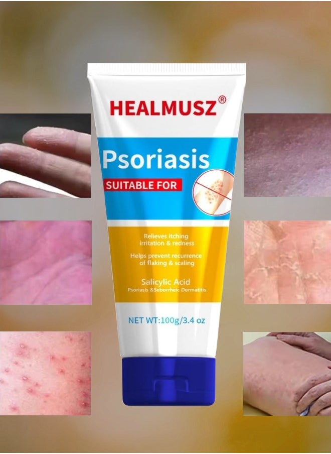 HEALMUSZ 100g Herbal Psoriasis Cream Antibacterial Psoriasis Cream with Herbal Ingredients for Relieve Psoriasis Skin Itching Inhibit Fungal Infection Psoriasis Treatment Cream Lotion  - Image 1