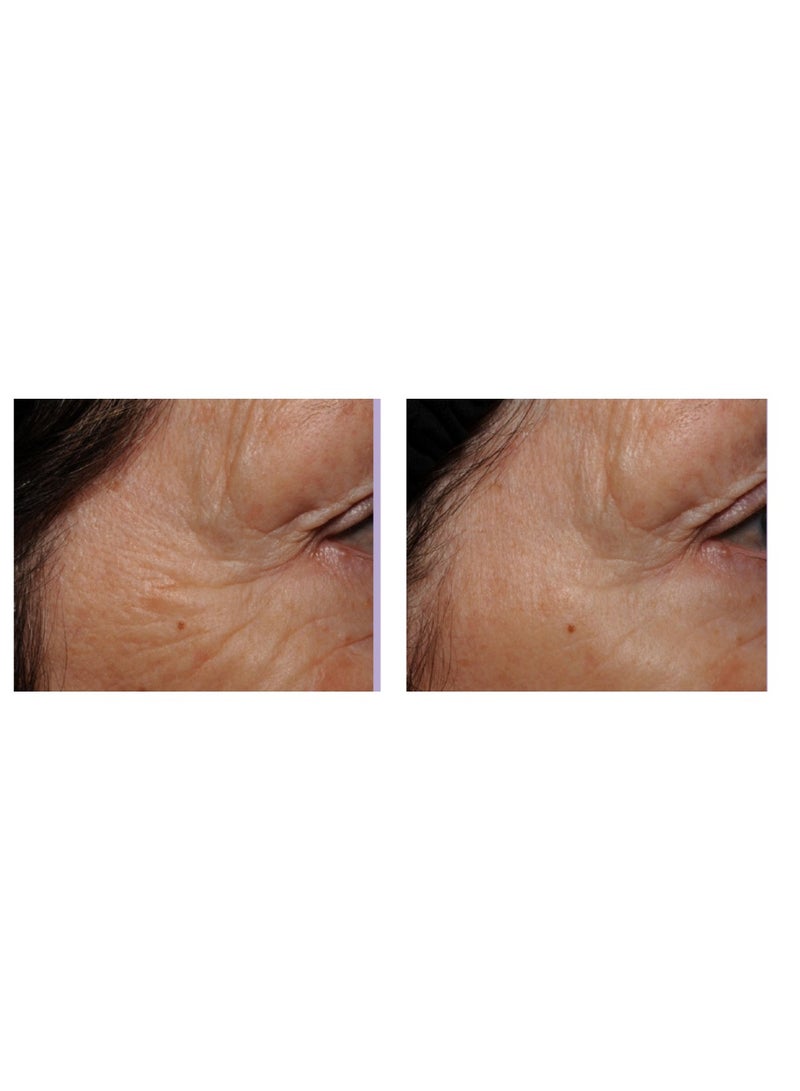 Neue Super Recovery Eye Serum - Image 4
