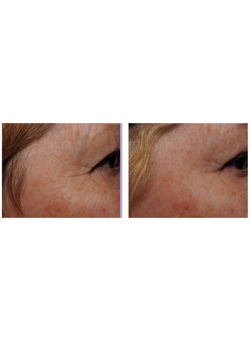 Neue Super Recovery Eye Serum - Image 5
