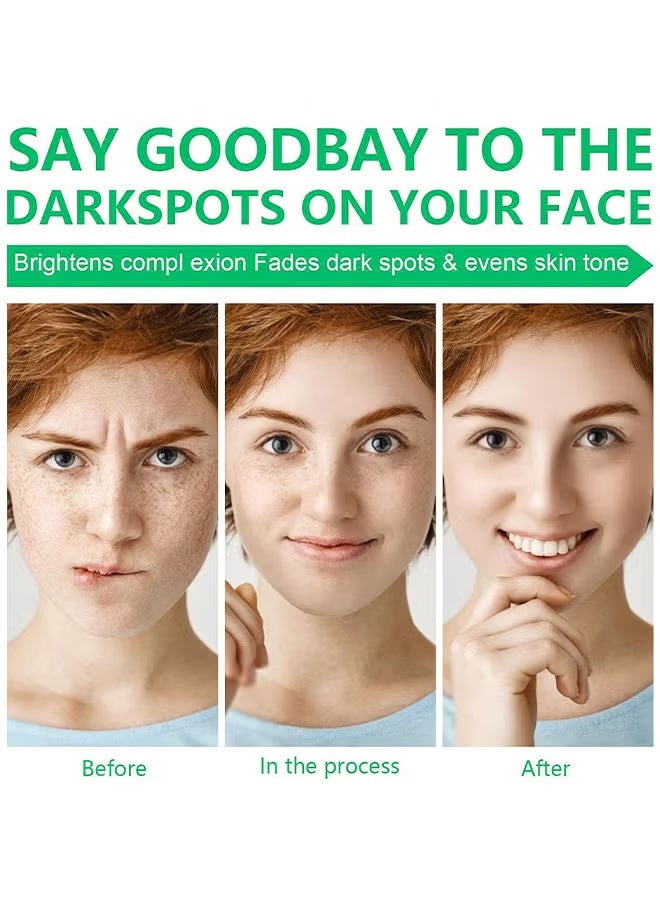 iBealee Dark Spot Correcting Glow Serum 50ML/1.69 fl. oz. Brightening Serum, Dark Spot Treatment, Hyperpigmentation Treatment - Image 4